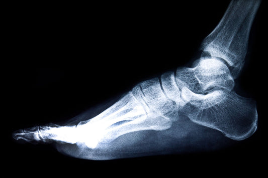 Bone Density